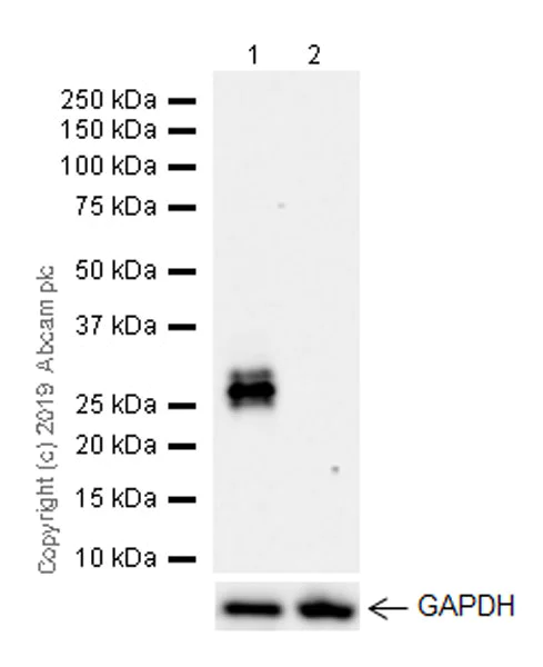 Western blot - Anti-CTHRC1 antibody [EPR22851-145] (AB256458)