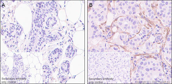 Immunohistochemistry (Formalin/PFA-fixed paraffin-embedded sections) - Anti-CTHRC1 antibody [EPR22851-145] - BSA and Azide free (AB259269)