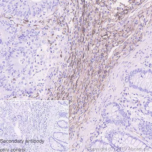 Immunohistochemistry (Formalin/PFA-fixed paraffin-embedded sections) - Anti-CTHRC1 antibody [EPR22851-145] - BSA and Azide free (AB259269)