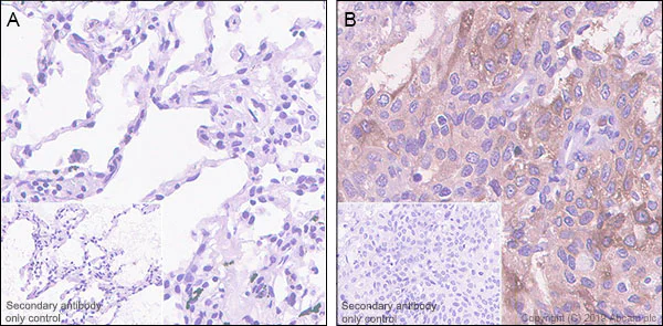 Immunohistochemistry (Formalin/PFA-fixed paraffin-embedded sections) - Anti-CTHRC1 antibody [EPR22851-145] - BSA and Azide free (AB259269)