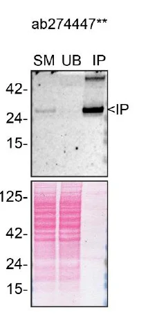 Immunoprecipitation - Anti-CTHRC1 antibody [EPR22851-215] - BSA and Azide free (Detector) (AB274447)