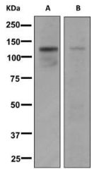 Anti-CtIP antibody [EPNCIR160]