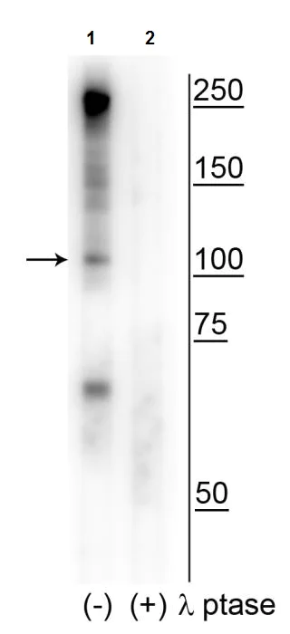 Western blot - Anti-CtIP (phospho S327) antibody (AB254067)