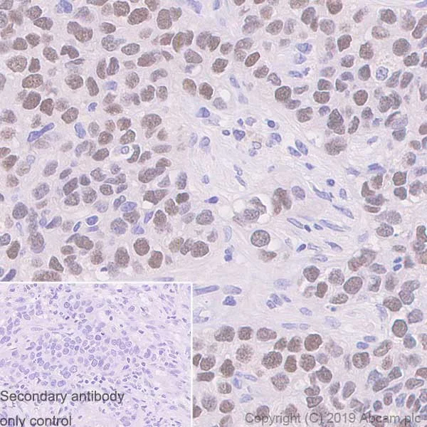 Immunohistochemistry (Formalin/PFA-fixed paraffin-embedded sections) - Anti-Ctip1/BCL-11A antibody [123] (AB119275)