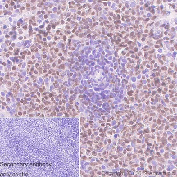 Immunohistochemistry (Formalin/PFA-fixed paraffin-embedded sections) - Anti-Ctip1/BCL-11A antibody [123] (AB119275)