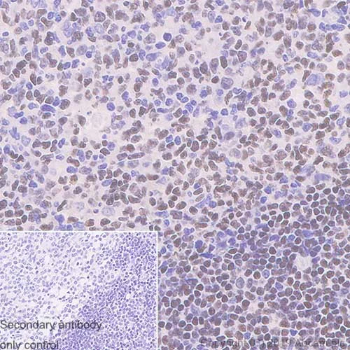Immunohistochemistry (Formalin/PFA-fixed paraffin-embedded sections) - Anti-Ctip1/BCL-11A antibody [123] (AB119275)