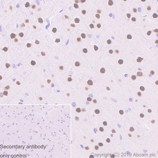 Immunohistochemistry (Formalin/PFA-fixed paraffin-embedded sections) - Anti-Ctip1/BCL-11A antibody [123] - BSA and Azide free (AB256127)