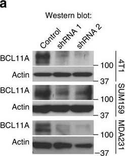 Western blot - Anti-Ctip1/BCL-11A antibody [14B5] (AB19487)