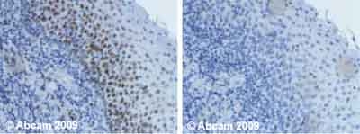 Immunohistochemistry (Formalin/PFA-fixed paraffin-embedded sections) - Anti-Ctip1/BCL-11A antibody [18B12DE6] (AB19489), expandable thumbnail