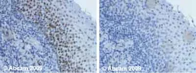 Immunohistochemistry (Formalin/PFA-fixed paraffin-embedded sections) - Anti-Ctip1/BCL-11A antibody [18B12DE6] (AB19489)