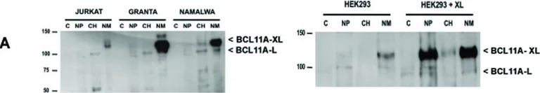 Western blot - Anti-Ctip1/BCL-11A antibody [18B12DE6] (AB19489)