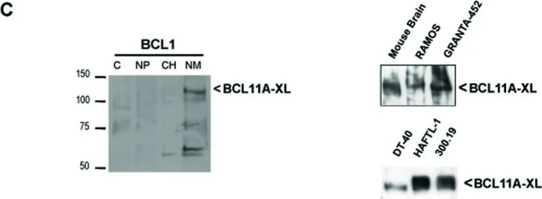 Western blot - Anti-Ctip1/BCL-11A antibody [18B12DE6] (AB19489)