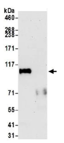 Immunoprecipitation - Anti-Ctip1/BCL-11A antibody [BLR073G] - BSA free (AB264423)