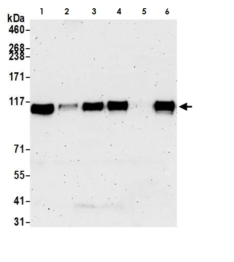 Western blot - Anti-Ctip1/BCL-11A antibody [BLR073G] - BSA free (AB264423)