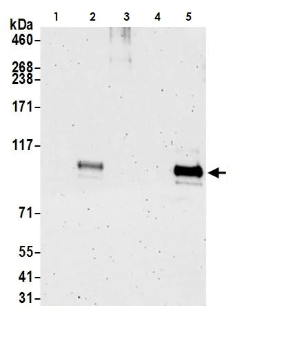Western blot - Anti-Ctip1/BCL-11A antibody [BLR073G] - BSA free (AB264423)