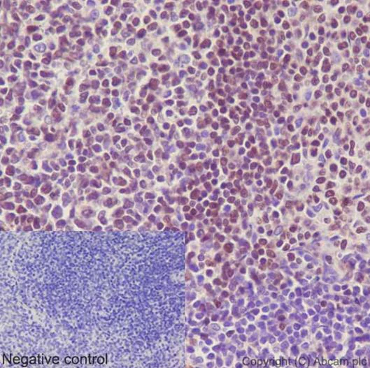 Immunohistochemistry (Formalin/PFA-fixed paraffin-embedded sections) - Anti-Ctip1/BCL-11A antibody [EPR14943-44] (AB191401)