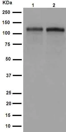 Western blot - Anti-Ctip1/BCL-11A antibody [EPR14943-44] (AB191401)