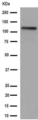Western blot - Anti-Ctip1/BCL-11A antibody [EPR14943-44] (AB191401)