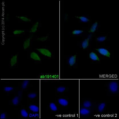 Immunocytochemistry/ Immunofluorescence - Anti-Ctip1/BCL-11A antibody [EPR14943-44] - BSA and Azide free (AB242406)