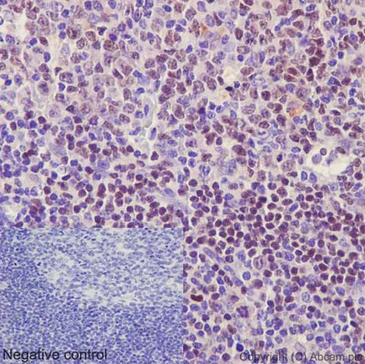 Immunohistochemistry (Formalin/PFA-fixed paraffin-embedded sections) - Anti-Ctip1/BCL-11A antibody [EPR14943-44] - BSA and Azide free (AB242406)