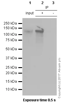 Immunoprecipitation - Anti-Ctip1/BCL-11A antibody [EPR14943-44] - BSA and Azide free (AB242406)