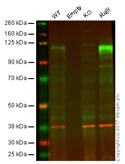 Western blot - Anti-Ctip1/BCL-11A antibody [EPR14943-44] - BSA and Azide free (AB242406)