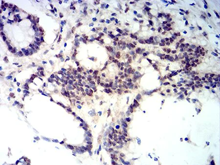 Immunohistochemistry (Formalin/PFA-fixed paraffin-embedded sections) - Anti-Ctip2 antibody [1F8G8] (AB233713)
