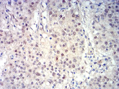 Immunohistochemistry (Formalin/PFA-fixed paraffin-embedded sections) - Anti-Ctip2 antibody [1F8G8] (AB233713)