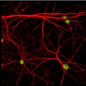 Immunocytochemistry/ Immunofluorescence - Anti-Ctip2 antibody [25B6] (AB18465), expandable thumbnail