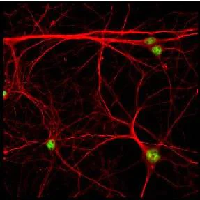Immunocytochemistry/ Immunofluorescence - Anti-Ctip2 antibody [25B6] (AB18465)