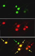 Immunocytochemistry/ Immunofluorescence - Anti-Ctip2 antibody [25B6] (AB18465), expandable thumbnail