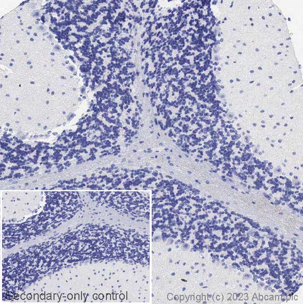 Immunohistochemistry (Formalin/PFA-fixed paraffin-embedded sections) - Anti-Ctip2 antibody [25B6] (ab18465), expandable thumbnail