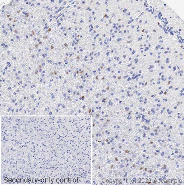 Immunohistochemistry (Formalin/PFA-fixed paraffin-embedded sections) - Anti-Ctip2 antibody [25B6] (AB18465), expandable thumbnail