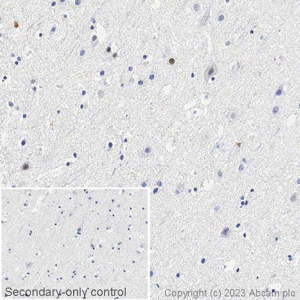 Immunohistochemistry (Formalin/PFA-fixed paraffin-embedded sections) - Anti-Ctip2 antibody [25B6] (ab18465), expandable thumbnail