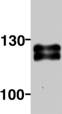 Western blot - Anti-Ctip2 antibody [25B6] (AB18465), expandable thumbnail