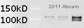 Western blot - Anti-Ctip2 antibody [25B6] (AB18465)