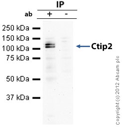 Immunoprecipitation - Anti-Ctip2 antibody (AB28448), expandable thumbnail