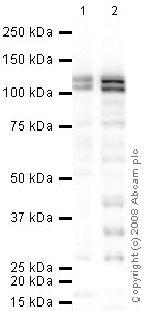 Western blot - Anti-Ctip2 antibody (AB28448), expandable thumbnail