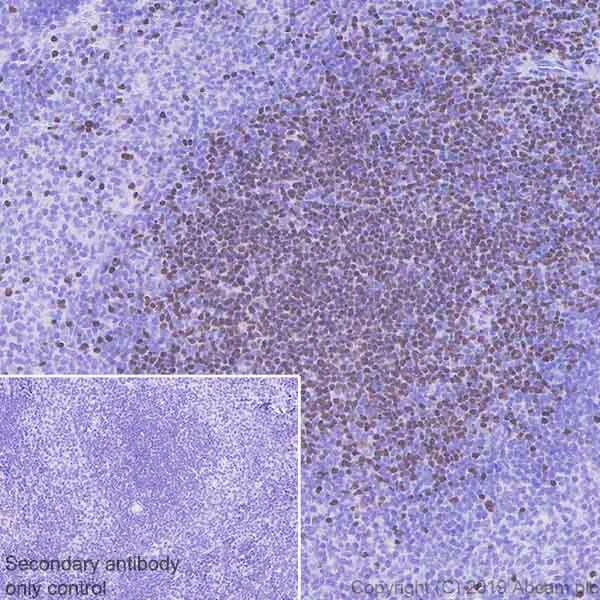 Immunohistochemistry (Formalin/PFA-fixed paraffin-embedded sections) - Anti-Ctip2 antibody [EPR23120-25] (AB240636)