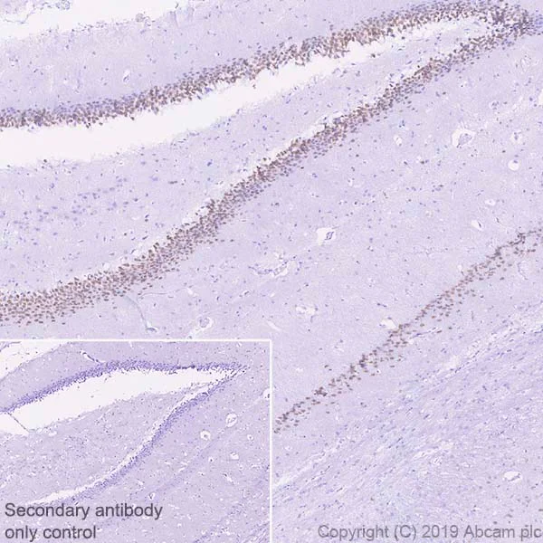 Immunohistochemistry (Formalin/PFA-fixed paraffin-embedded sections) - Anti-Ctip2 antibody [EPR23120-25] (AB240636)