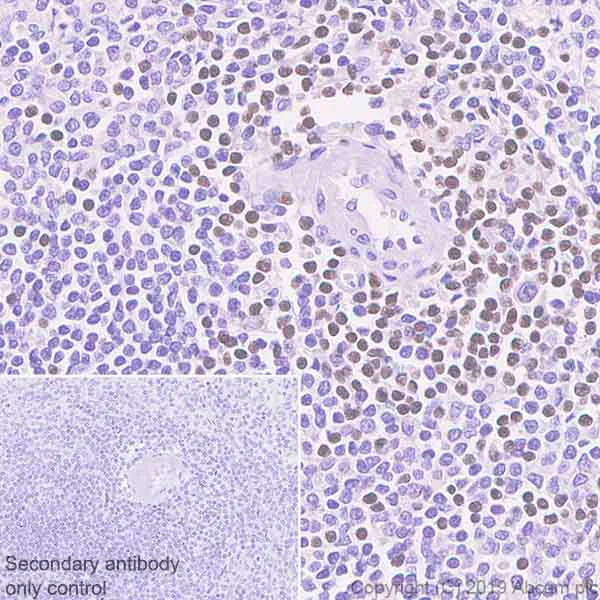 Immunohistochemistry (Formalin/PFA-fixed paraffin-embedded sections) - Anti-Ctip2 antibody [EPR23120-25] (AB240636)