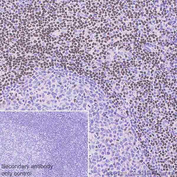 Immunohistochemistry (Formalin/PFA-fixed paraffin-embedded sections) - Anti-Ctip2 antibody [EPR23120-25] (AB240636)