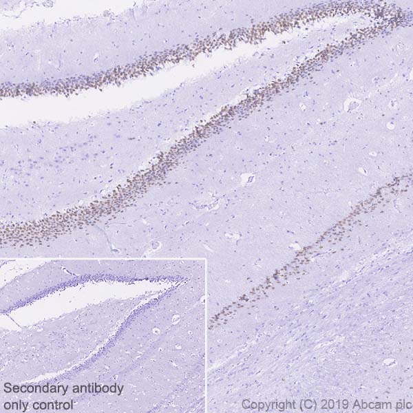 Immunohistochemistry (Formalin/PFA-fixed paraffin-embedded sections) - Anti-Ctip2 antibody [EPR23120-25] - BSA and Azide free (AB269367), expandable thumbnail