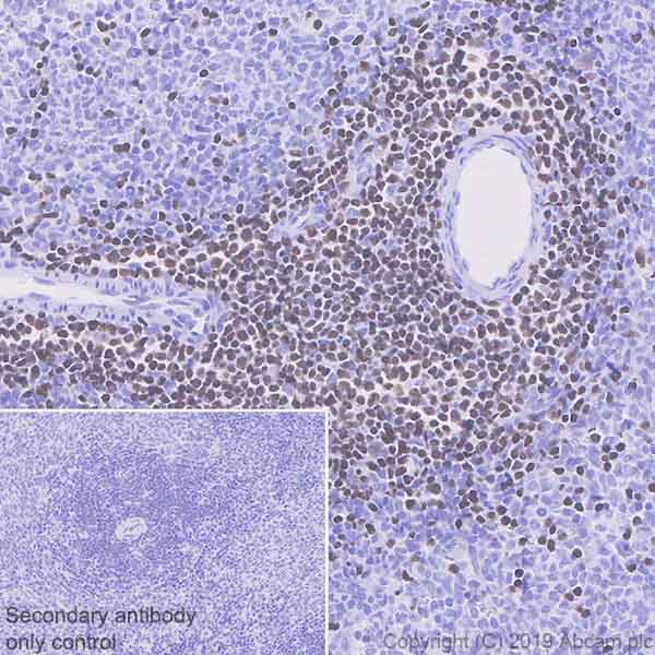 Immunohistochemistry (Formalin/PFA-fixed paraffin-embedded sections) - Anti-Ctip2 antibody [EPR23120-25] - BSA and Azide free (AB269367), expandable thumbnail