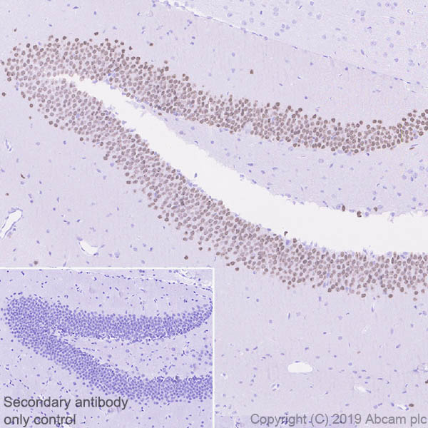 Immunohistochemistry (Formalin/PFA-fixed paraffin-embedded sections) - Anti-Ctip2 antibody [EPR23120-25] - BSA and Azide free (ab269367), expandable thumbnail
