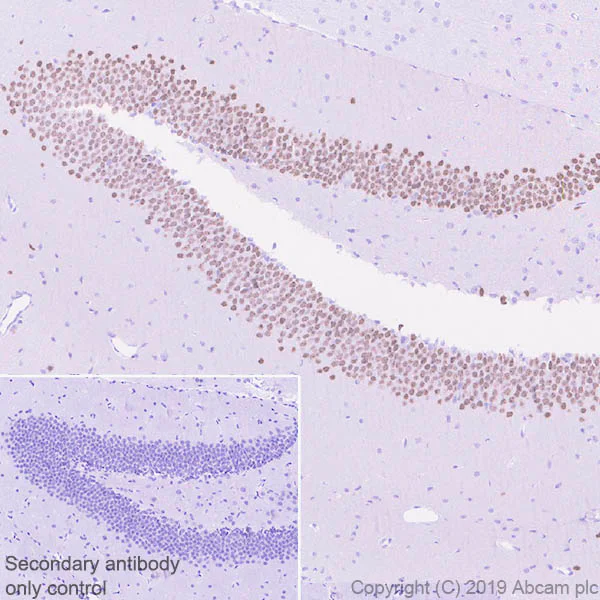 Immunohistochemistry (Formalin/PFA-fixed paraffin-embedded sections) - Anti-Ctip2 antibody [EPR23120-25] - BSA and Azide free (AB269367)