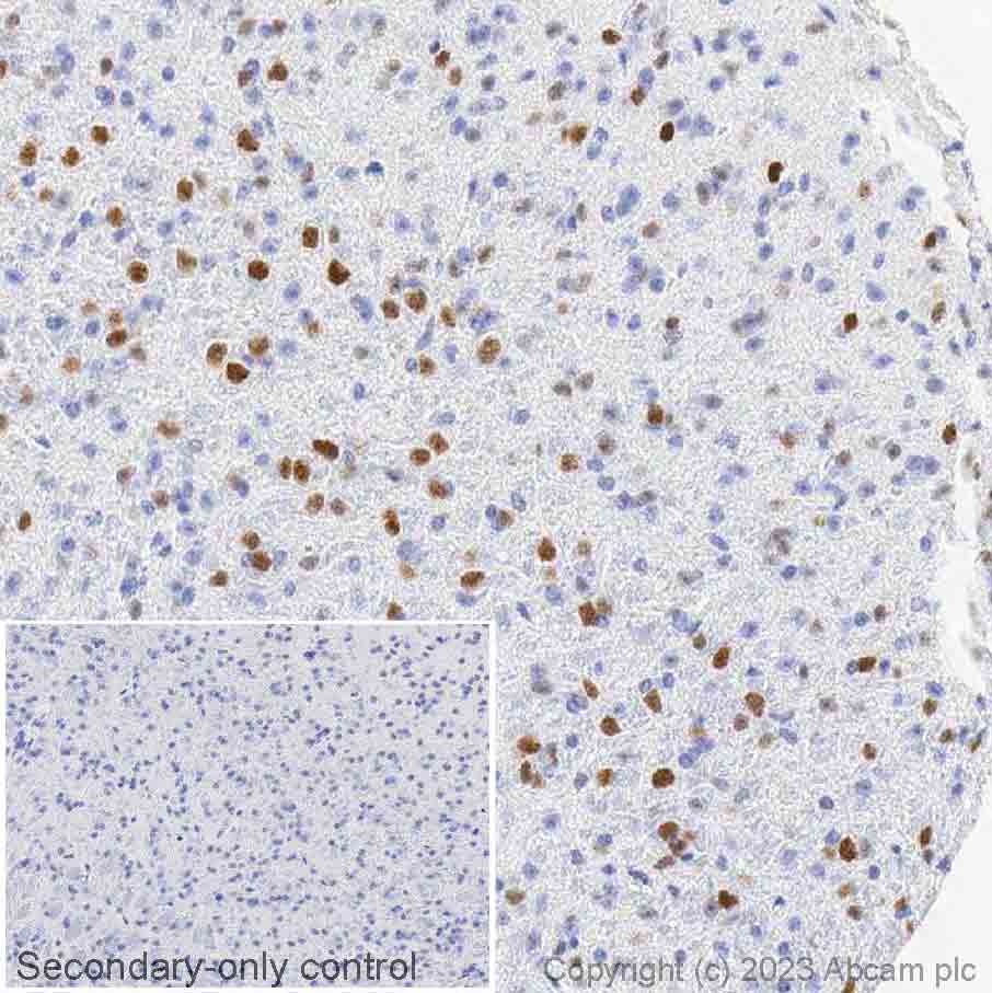 Immunohistochemistry (Formalin/PFA-fixed paraffin-embedded sections) - Anti-Ctip2 antibody [EPR23120-25] - BSA and Azide free (ab269367), expandable thumbnail