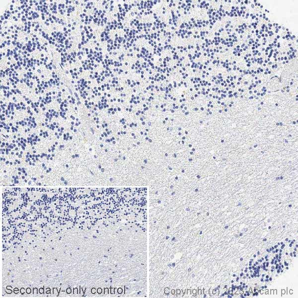 Immunohistochemistry (Formalin/PFA-fixed paraffin-embedded sections) - Anti-Ctip2 antibody [EPR23120-25] - BSA and Azide free (ab269367), expandable thumbnail