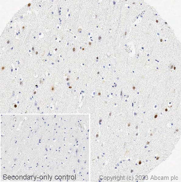 Immunohistochemistry (Formalin/PFA-fixed paraffin-embedded sections) - Anti-Ctip2 antibody [EPR23120-25] - BSA and Azide free (ab269367), expandable thumbnail