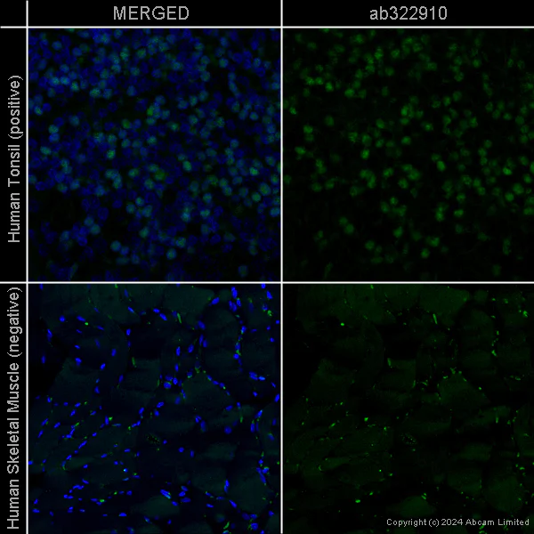 Immunohistochemistry (Formalin/PFA-fixed paraffin-embedded sections) - Anti-Ctip2 antibody [EPR23120-25] – Rat IgG2a (Chimeric) (AB322910)